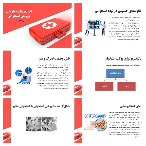 دریافت پاورپوینت اثر تمرینات مقاومتی بر پوکی استخوان